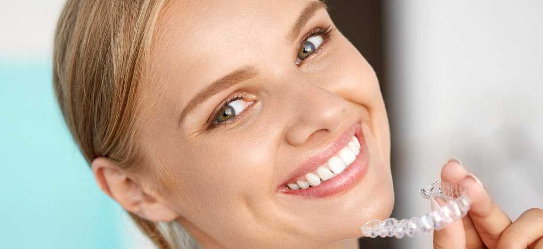 Clear Aligners – Why Should You Use Clear Aligners?