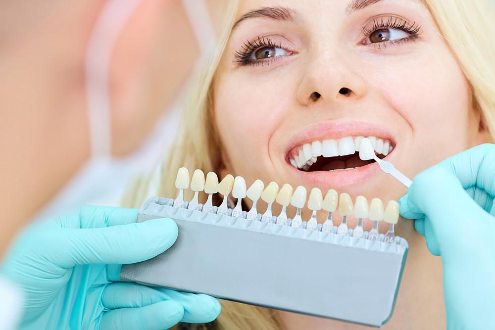 The Best Way to Get Your Teeth Whitened on a Budget