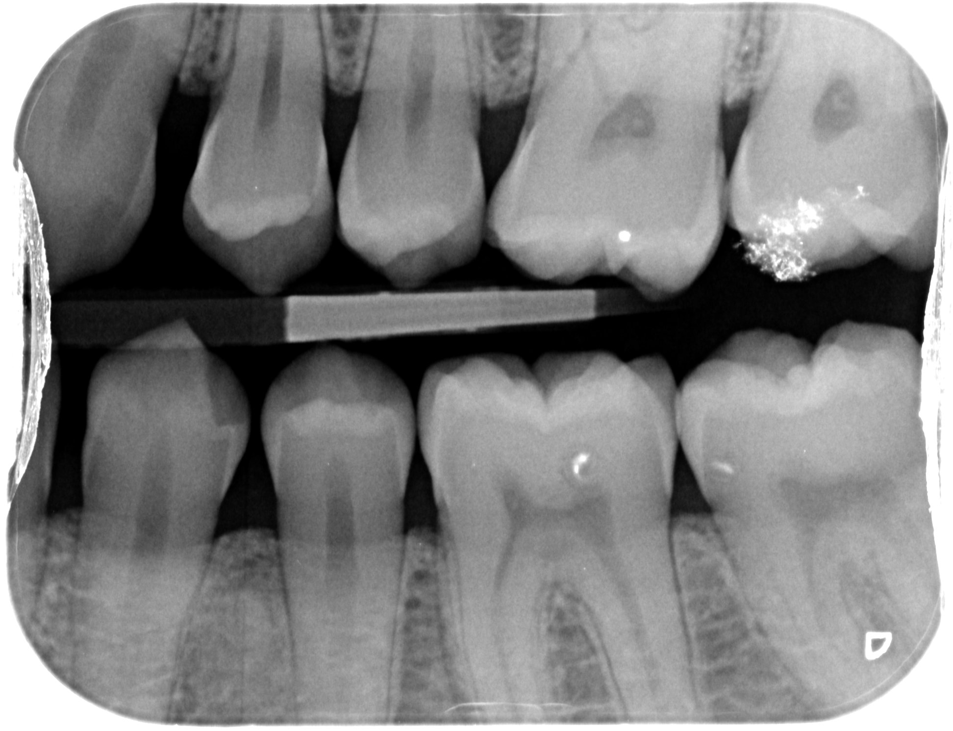 Dental Radiography and Cone Beam Computed Tomography