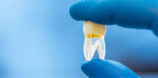 The Future of Regenerative Dentistry and Stem Cell Therapies: What’s Next for Your Smile?