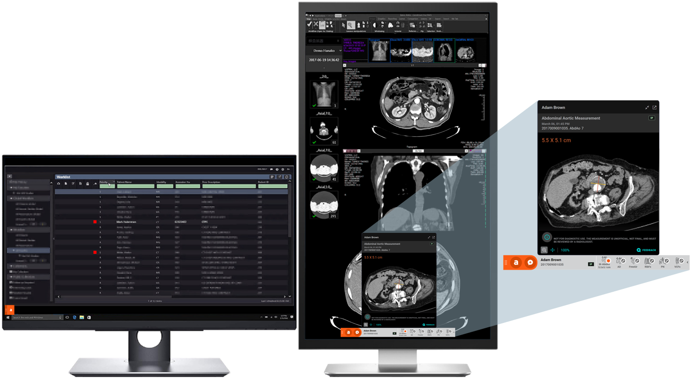 The Surgeon’s New Co-Pilot: How AI is Transforming Pre-Op Planning and Risk Assessment