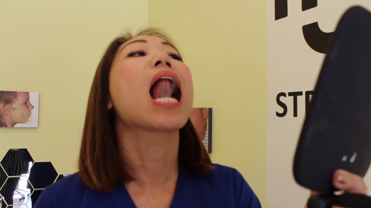 The Sneaky Culprit Behind Crooked Teeth (Again): How Myofunctional Therapy Saves Your Smile