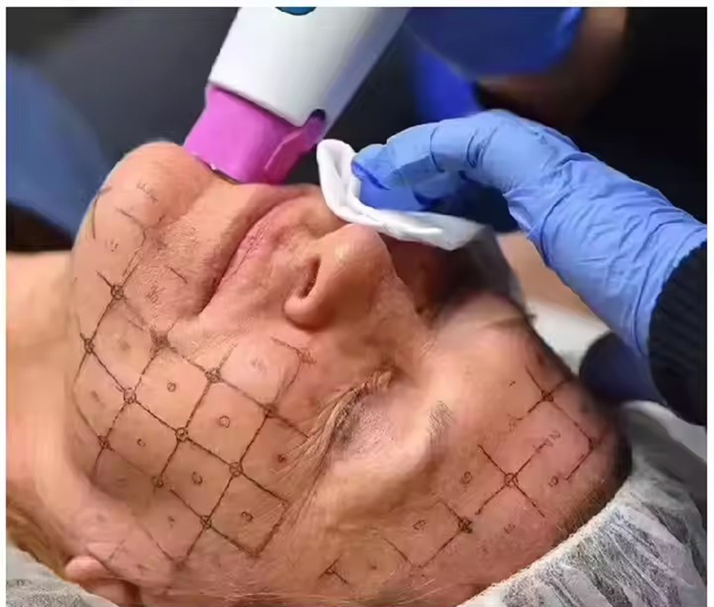 The Evolution and Future of Non-Invasive and Minimally Invasive Cosmetic Procedures