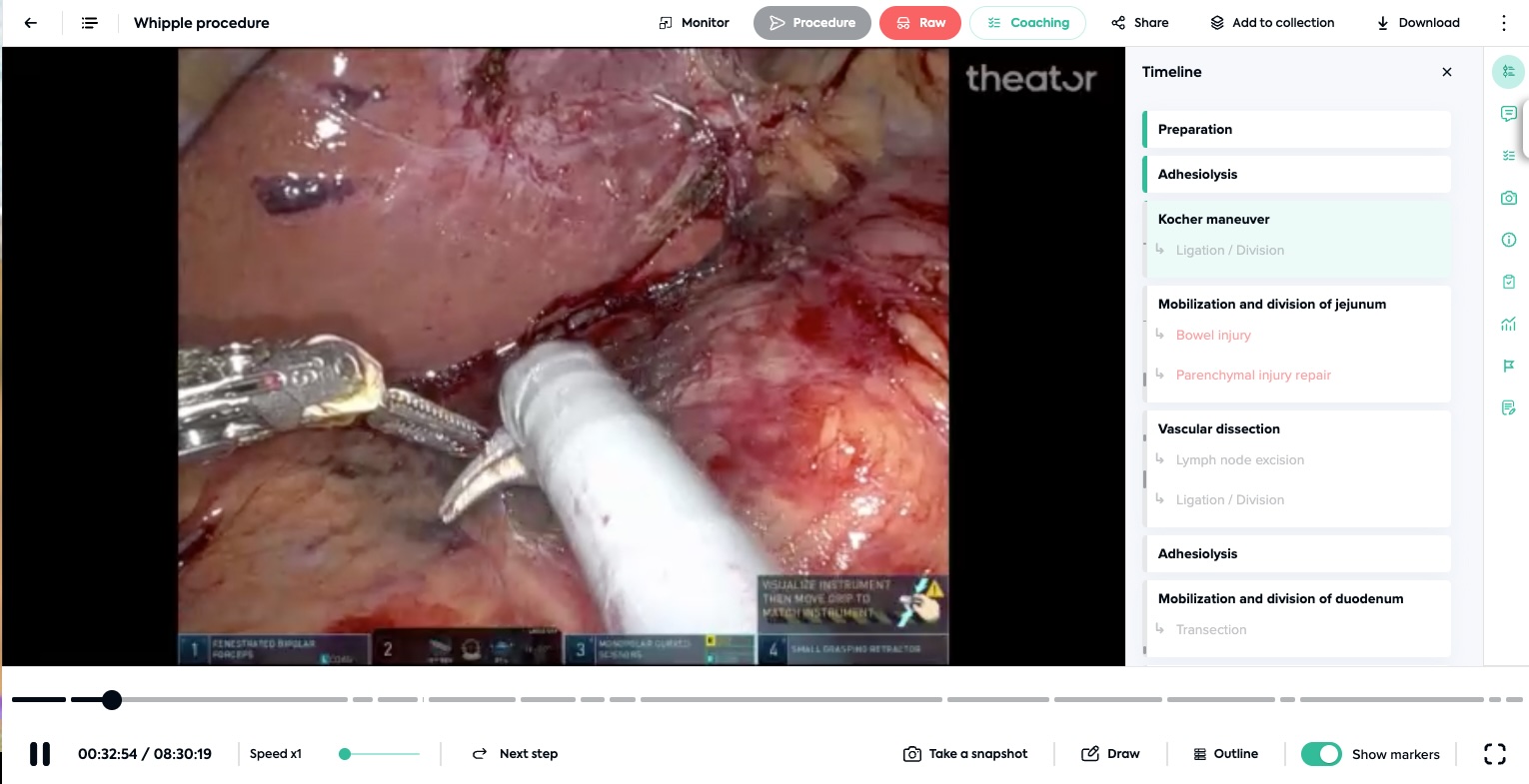 The Surgeon’s New Co-Pilot: How AI is Predicting Surgical Outcomes Before the First Incision