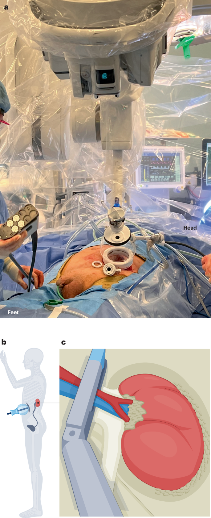 Digital detox for mental health in a hyperconnected world